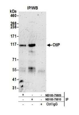 Immunoprecipitation: CtIP Antibody [NB100-79810]