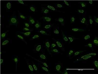 Immunocytochemistry/ Immunofluorescence: Ctip1 Antibody (3D9) [H00053335-M03]