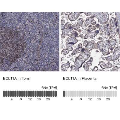 Immunocytochemistry/ Immunofluorescence: Ctip1 Antibody [NBP3-17030]