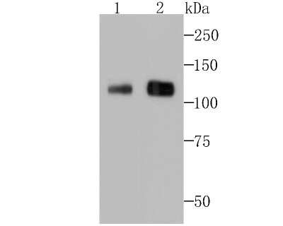 Western Blot: Ctip1 Antibody (JB35-68) [NBP2-75455]