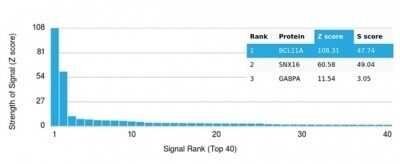 Protein Array: Ctip1 Antibody (PCRP-BCL11A-1G10) [NBP3-13737]