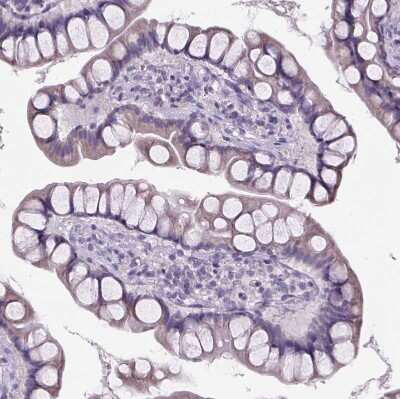 Immunohistochemistry-Paraffin: Cubilin Antibody [NBP2-62596]