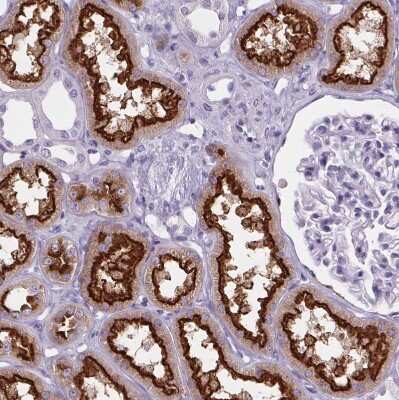 Immunohistochemistry-Paraffin: Cubilin Antibody [NBP2-62611]