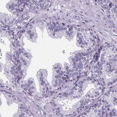 Immunohistochemistry-Paraffin: Cubilin Antibody [NBP2-62611]