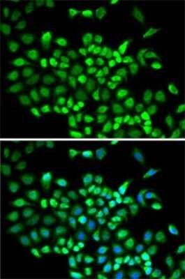 Immunocytochemistry/ Immunofluorescence: Cullin 2 Antibody - BSA Free [NBP2-92651]