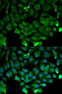 Immunocytochemistry/ Immunofluorescence: Cullin 3 Antibody - Azide and BSA Free [NBP2-92848]