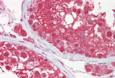 Immunohistochemistry: Cullin 3 Antibody [NBP2-88798]