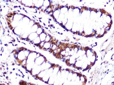 Immunohistochemistry-Paraffin: Cullin 4a Antibody (5P4M1) [NBP3-16539]