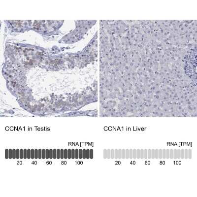 Immunocytochemistry/ Immunofluorescence: Cyclin A1 Antibody [NBP3-16995]