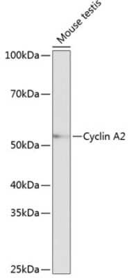 Western Blot: Cyclin A2 Antibody (3E9Z3) [NBP3-15625]
