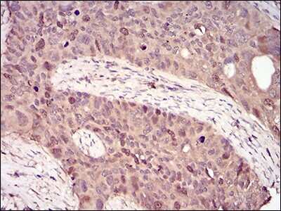 Immunohistochemistry: Cyclin A2 Antibody (6B4D11) - BSA Free [NBP2-52436]