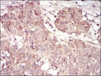 Immunohistochemistry: Cyclin A2 Antibody (6B4D11) - BSA Free [NBP2-52436]