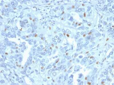 Immunohistochemistry-Paraffin: Cyclin A2 Antibody (CCNA2/2333) [NBP3-07468]