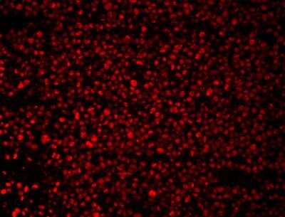 Immunohistochemistry-Paraffin: Cyclin A2 Antibody [NBP1-31330]