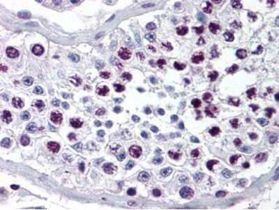 Immunohistochemistry-Paraffin: Cyclin A2 Antibody [NB600-495]