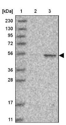 Western Blot: Cyclin A2 Antibody [NBP1-88156]