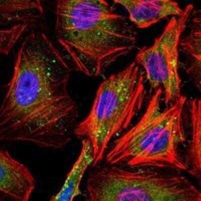 Immunocytochemistry/ Immunofluorescence: Cyclin B1 Antibody (5G6) - BSA Free [NBP1-51669]