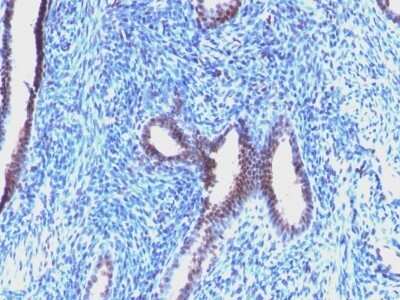 Immunohistochemistry-Paraffin: Cyclin B1 Antibody (CCNB1/1098) - Azide and BSA Free [NBP2-47893]