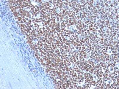 Immunohistochemistry-Paraffin: Cyclin B1 Antibody (CCNB1/1098) - IHC-Prediluted [NBP2-48117]
