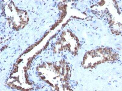 Immunohistochemistry-Paraffin: Cyclin B1 Antibody (CCNB1/1098) - IHC-Prediluted [NBP2-48117]