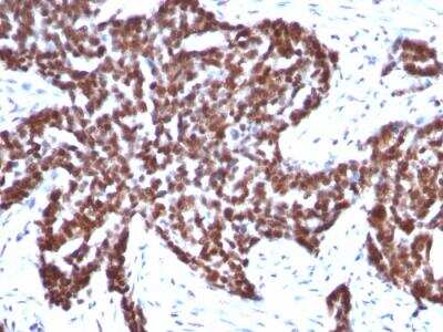 Immunohistochemistry-Paraffin: Cyclin B1 Antibody (CCNB1/1098) - IHC-Prediluted [NBP2-48117]