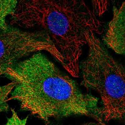 Immunocytochemistry/ Immunofluorescence: Cyclin B1 Antibody [NBP2-56867]