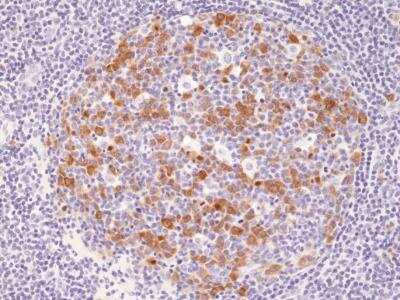 Immunohistochemistry-Paraffin: Cyclin B1 Antibody (RM281) [NBP2-61517]