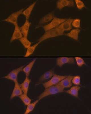 Immunocytochemistry/ Immunofluorescence: Cyclin B2 Antibody (1L9B9) [NBP3-16663]