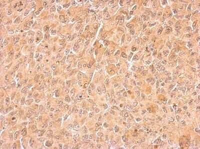 Immunohistochemistry-Paraffin: Cyclin B2 Antibody [NBP1-33031]
