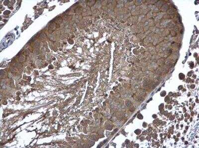 Immunohistochemistry-Paraffin: Cyclin B2 Antibody [NBP1-33031]