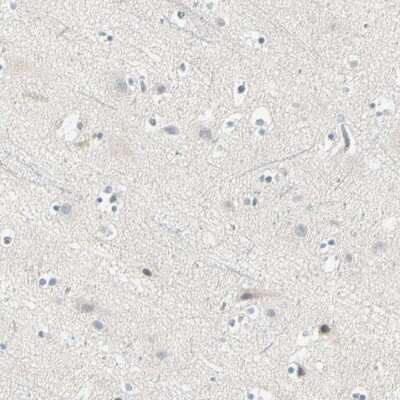 Immunohistochemistry-Paraffin: Cyclin B2 Antibody [NBP1-89657]