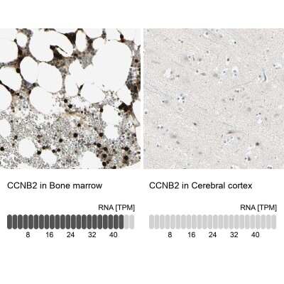 Immunohistochemistry-Paraffin: Cyclin B2 Antibody [NBP1-89657]