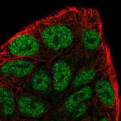 Immunocytochemistry/ Immunofluorescence: Cyclin C Antibody [NBP2-56402]