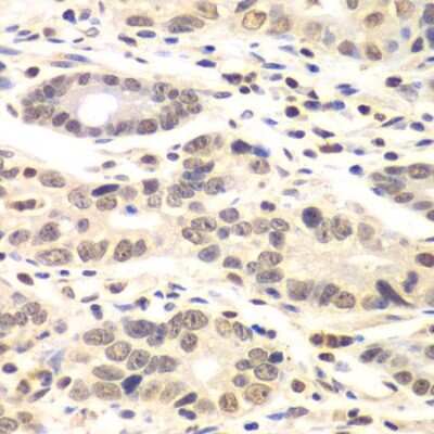 Immunohistochemistry-Paraffin: Cyclin C Antibody - BSA Free [NBP2-92902]