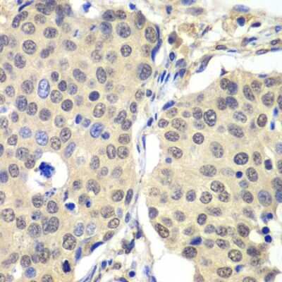 Immunohistochemistry-Paraffin: Cyclin C Antibody - BSA Free [NBP2-92902]