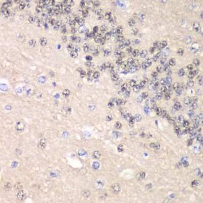 Immunohistochemistry-Paraffin: Cyclin C Antibody - BSA Free [NBP2-92902]