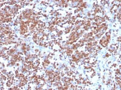 Immunohistochemistry-Paraffin: Cyclin D1 Antibody (CCND1/3370R) [NBP3-07209]