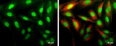 Immunocytochemistry/ Immunofluorescence: Cyclin D1 Antibody [NBP2-16054]
