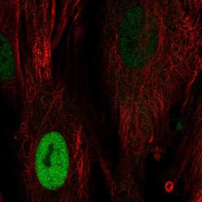 Immunocytochemistry/ Immunofluorescence: Cyclin D1 Antibody [NBP2-58667]