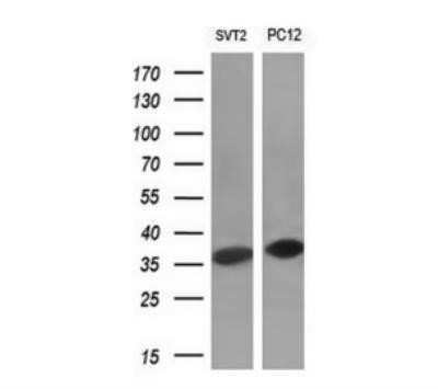 Western Blot: Cyclin D1 Antibody (OTI1G2)Azide and BSA Free [NBP2-70244]