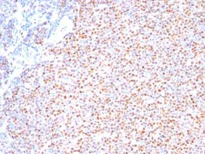 Immunohistochemistry-Paraffin: Cyclin D1 Antibody (SPM587) [NBP2-32840]
