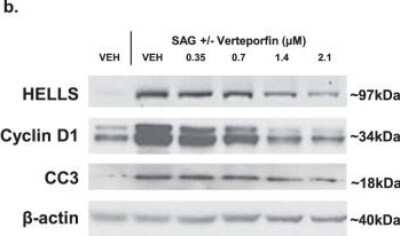 Western Blot: Cyclin D1 Antibody (SPM587) [NBP2-32840]