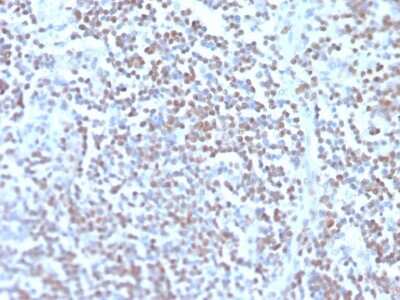 Immunohistochemistry-Paraffin: Cyclin D1 Antibody (rCCND1/4752) [NBP3-07207]