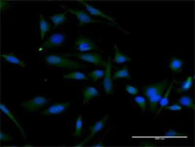 Immunocytochemistry/ Immunofluorescence: Cyclin D2 Antibody [H00000894-D01P]