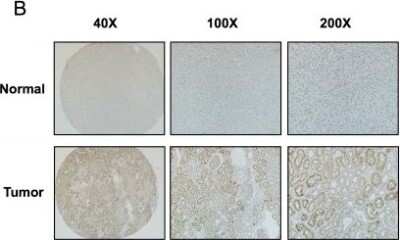 Immunohistochemistry: Cyclin D2 Antibody [NBP2-14460]