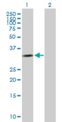 Western Blot: Cyclin D2 Antibody [H00000894-B01P]