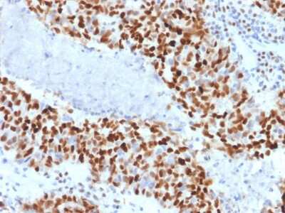 Immunohistochemistry-Paraffin: Cyclin E1 Antibody (CCNE1/2460) [NBP3-07484]