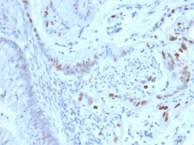 Immunohistochemistry-Paraffin: Cyclin E1 Antibody (CCNE1/2460) - Azide and BSA Free [NBP3-08805]