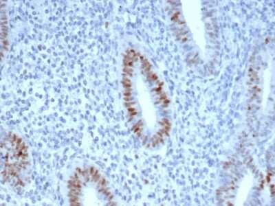 Immunohistochemistry-Paraffin: Cyclin E1 Antibody (CCNE1/4935R) [NBP3-07488]