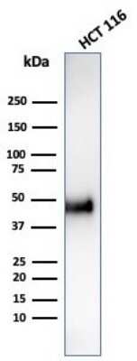 Western Blot: Cyclin E1 Antibody (CCNE1/4935R) [NBP3-07488]